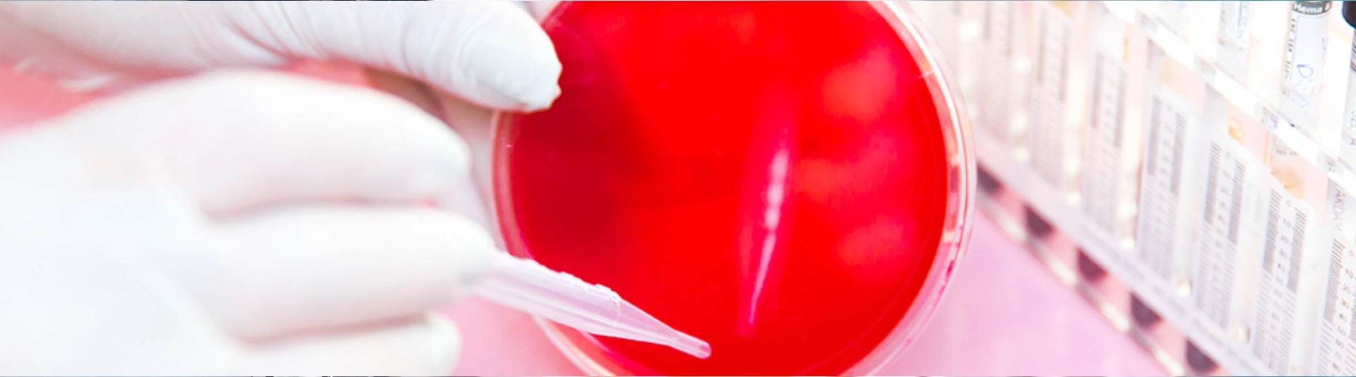 Hämatologie & internistische Onkologie